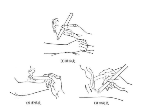 懸灸是什么東西？和艾灸有什么區別嗎？